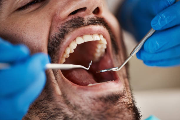 Trusted AR Emergency Dental Service Experts