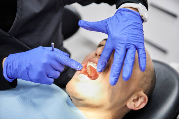 Best Dental Abscess Treatment in Johnson, AR